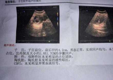广州代孕流程：农历七月助孕是鬼胎吗更新时间